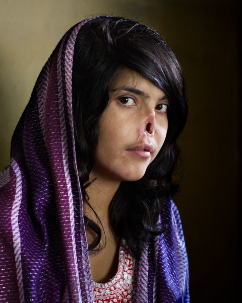 This photo of Afghan woman Aesha Mohammadzai appeared on the cover of Time magazine in August 2010. Her Taliban husband and in-laws punished her for running away by hacking off her nose and ears and leaving her for dead. <a href="https://www.cnn.com/interactive/2012/05/world/saving.aesha/index.html" target="_blank">She became a symbol</a> of the oppression of women in her war-torn country. She was flown to the United States, where she underwent multiple surgeries to reconstruct her nose.