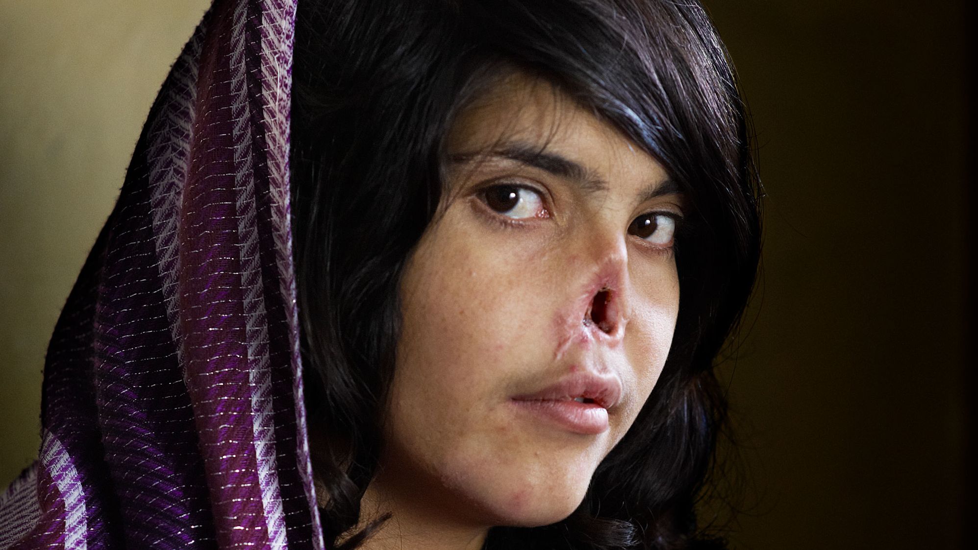 This photo of Afghan woman Aesha Mohammadzai appeared on the cover of Time magazine in August 2010. Her Taliban husband and in-laws punished her for running away by hacking off her nose and ears and leaving her for dead. <a href="https://www.cnn.com/interactive/2012/05/world/saving.aesha/index.html" target="_blank">She became a symbol</a> of the oppression of women in her war-torn country. She was flown to the United States, where she underwent multiple surgeries to reconstruct her nose.