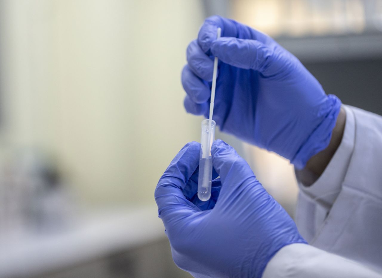 A health worker holds a coronavirus test in Ankara, Turkey, on December 29.