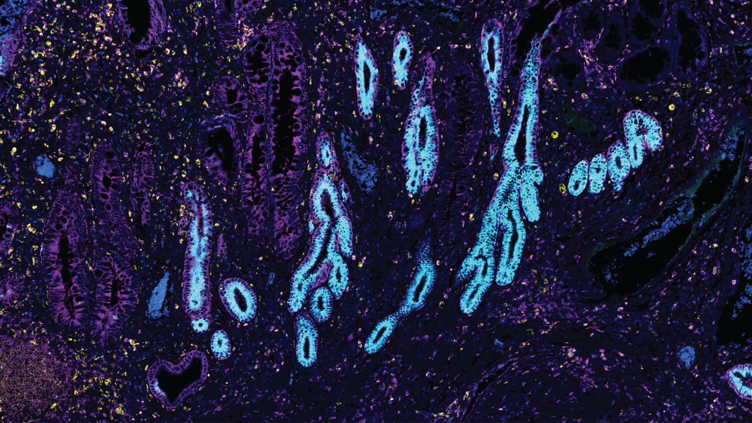 Scientists have mapped the gastrointestinal tract using from data from 1.6 million cells, including gut tissue pictured here.