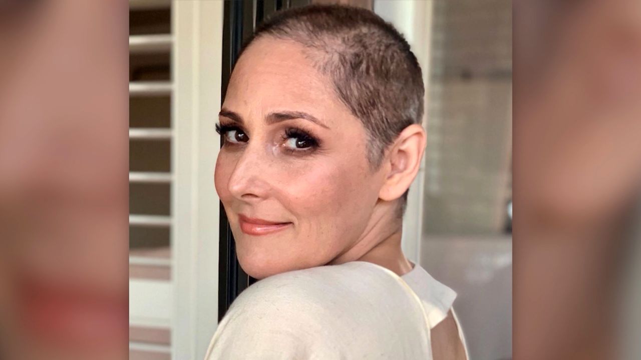 Ricki Lake Hair Loss Instagram