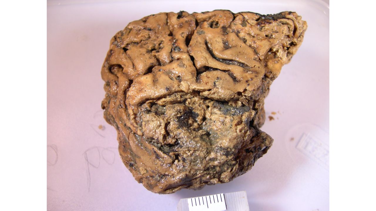 The folds of the brain remain well-preserved.