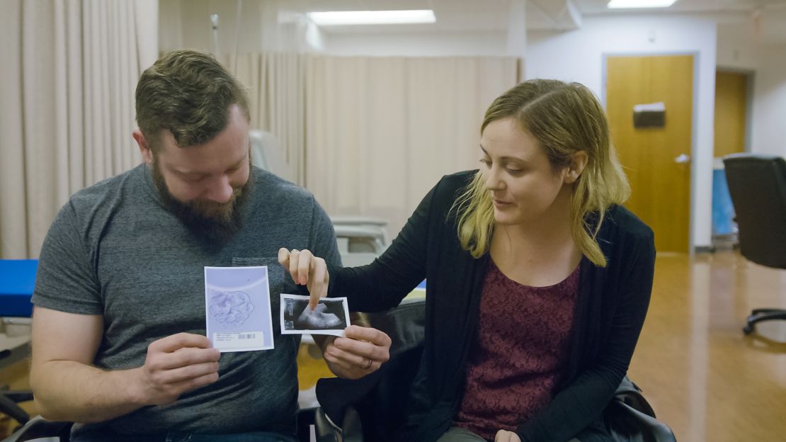 Drew and Jennifer Gobrecht holding ultrasound images of their son Benjamin Thomas Gobrecht after finding out that they are pregnant. 