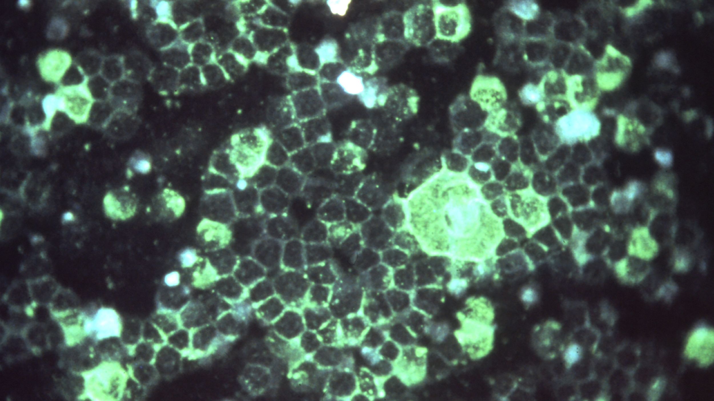 Respiratory syncytial virus (RSV), seen under a fluorescence microscope.