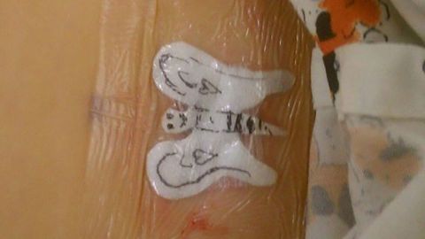 Kennedy Whipkey woke up to this illustration after surgery.