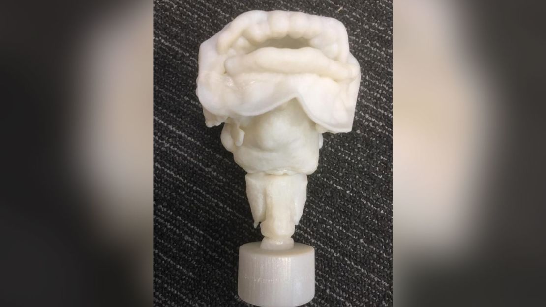 3-D printed vocal tract of Nesyamun