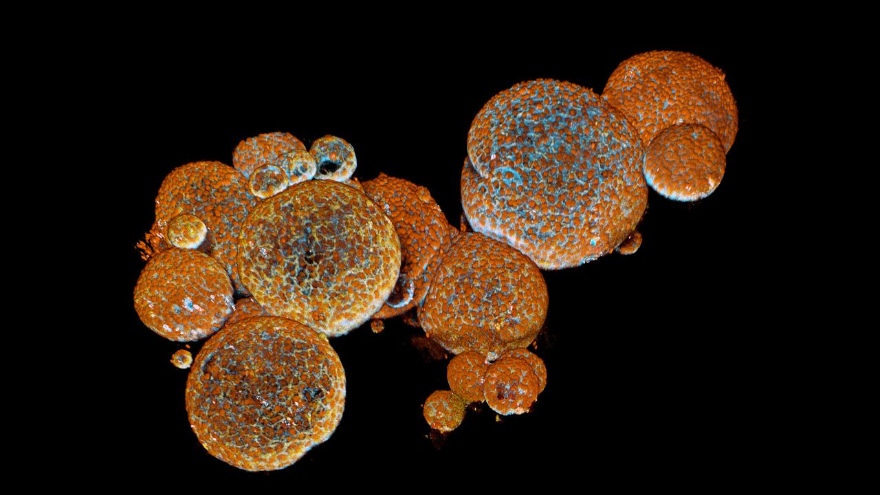 The snake venom gland organoids as seen under a microscope./