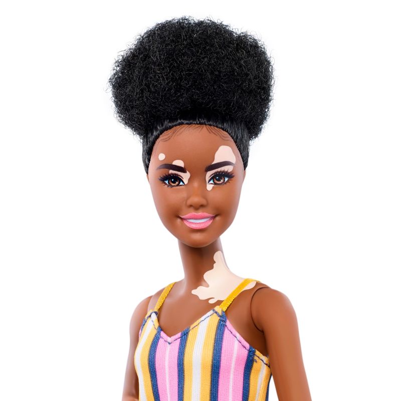 New Barbie dolls feature vitiligo and hairless models in bid to