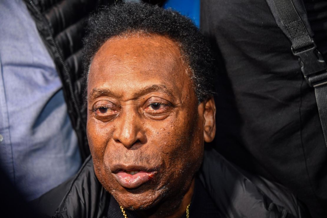 Pele says his mental state is "normal" for his age