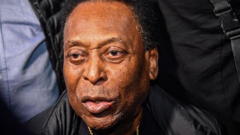 Pele says his mental state is "normal" for his age