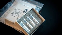 US Centers for Disease Control and Prevention's laboratory test kit for the 2019 novel coronavirus (2019-nCoV). 