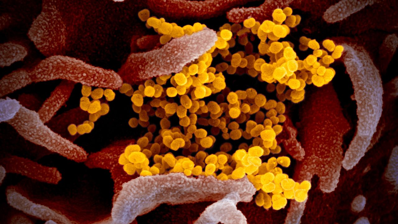 This scanning electron microscope image shows SARS-CoV-2 (yellow) --also known as 2019-nCoV, the virus that causes COVID-19 -- isolated from a patient in the US, emerging from the surface of cells (pink) cultured in the lab. 