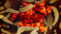 This scanning electron microscope image shows SARS-CoV-2 (orange)—also known as 2019-nCoV, the virus that causes COVID-19—isolated from a patient in the U.S., emerging from the surface of cells (green) cultured in the lab. Credit: NIAID-RML
