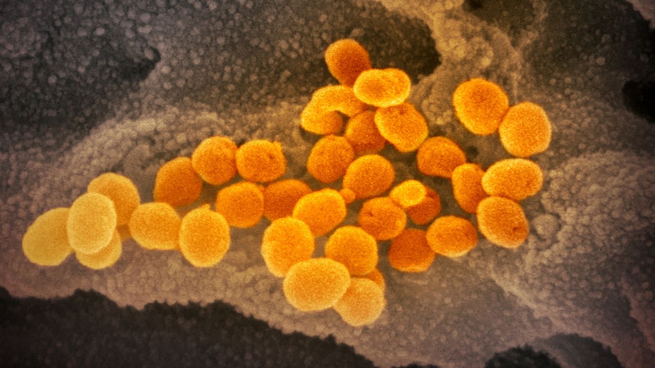 This scanning electron microscope image shows SARS-CoV-2 (orange)—also known as 2019-nCoV, the virus that causes COVID-19—isolated from a patient in the U.S., emerging from the surface of cells (gray) cultured in the lab. Credit: NIAID-RML