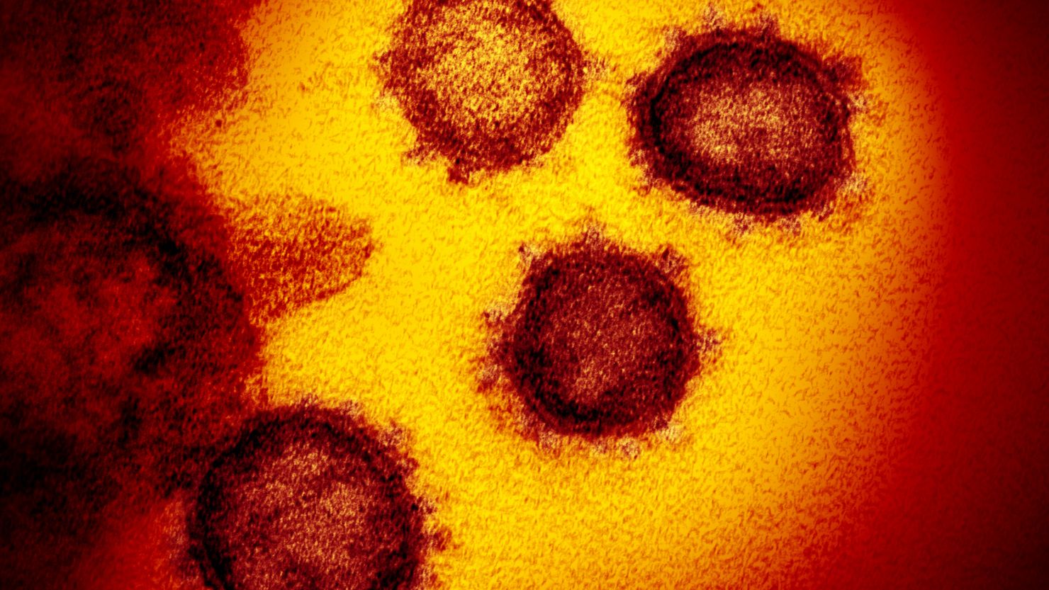 This transmission electron microscope image shows SARS-CoV-2—also known as 2019-nCoV, the virus that causes COVID-19. isolated from a patient in the U.S., emerging from the surface of cells cultured in the lab. Credit: NIAID-RML