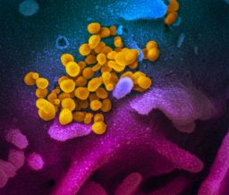 This scanning electron microscope image shows SARS-CoV-2 — the virus that causes Covid-19 — isolated from a patient in the US, emerging from the surface of cells cultured in the lab.