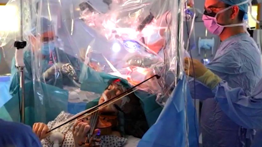 patient plays violin during surgery
