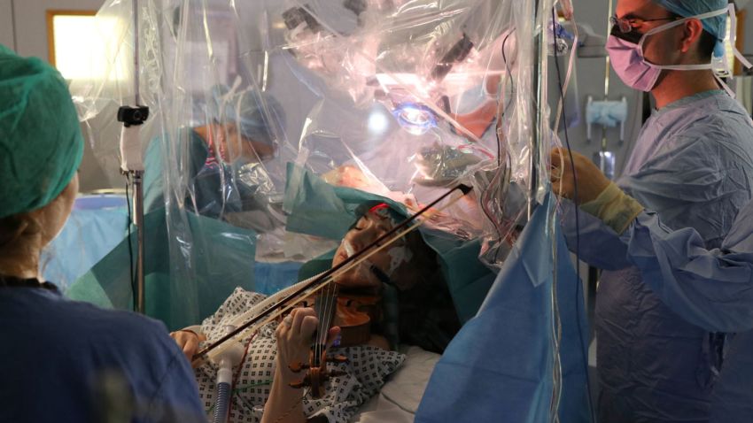 Dagmar Turner, 53, plays the violin as surgeons remove a tumor from her brain at King's College Hospital in London on Tuesday, February 18. The novel approach to the surgery was taken to preserve vital areas of the violinist's brain.