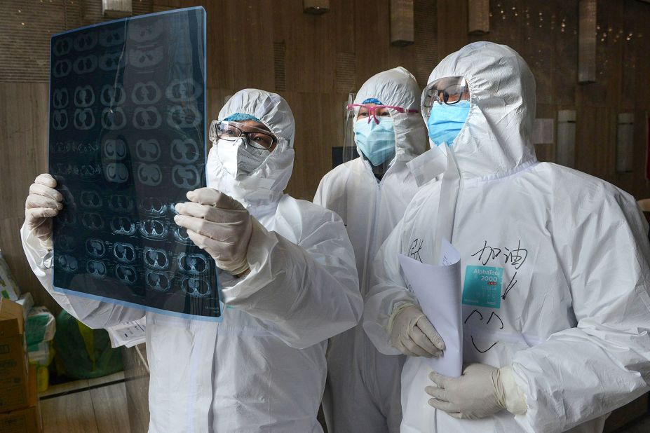 Doctors look at a CT scan of a lung at a hospital in Xiaogan, China, on February 20, 2020.