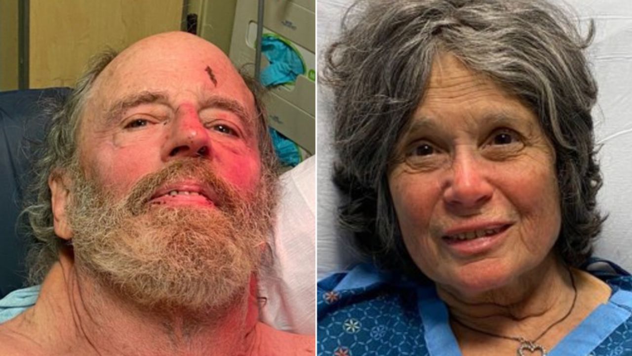 Ian Irwin, 72, and Carol Kiparsky, 77, are recovering in a hospital.
