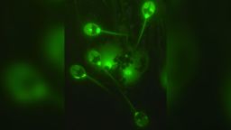 Fluorescence micrograph of spores of the parasitic cnidarian Henneguya salminicola. The fluorescent dye has penetrated the spore nuclei and membranes.