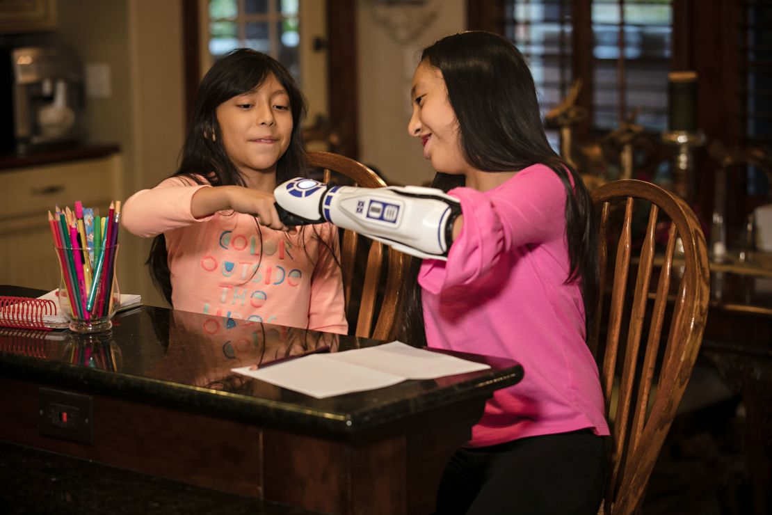 Isabella fist-bumps her sister after getting the bionic arm.