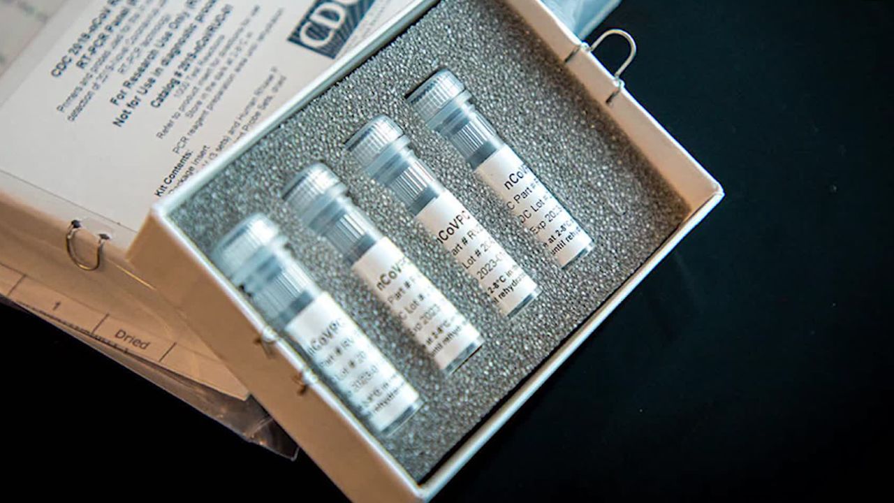A test kit designed by the US Centers for Disease Control and Prevention.
