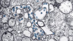 Transmission electron microscopic image of an isolate from the first U.S. case of COVID-19, formerly known as 2019-nCoV. The spherical viral particles, colorized blue, contain cross-section through the viral genome, seen as black dots.