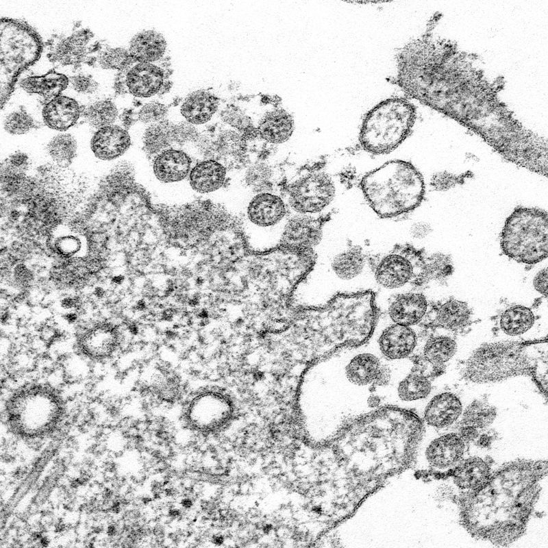 April 9, 2020 coronavirus news | CNN