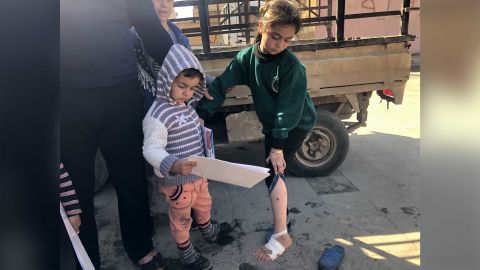 Dalaa shows the injuries she received in the airstrike