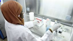 A scientific staff member works in a secure laboratory, researching the coronavirus, at the Pasteur Institute in Dakar on February 3, 2020. - The Pasteur Institute in Dakar, designated by the African Union as one of the two reference centres in Africa for the detection of the new coronavirus that appeared in China, is hosting experts from 15 countries on the continent this weekend to prepare them to deal with the disease. (Photo by Seyllou / AFP) (Photo by SEYLLOU/AFP via Getty Images)