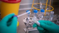 TOPSHOT - A laborant at the State Health Authorities of Baden-Wuerttemberg works on a test sample of a  suspected case of the 2019 Novel Coronavirus (2019-nCoV) in Stuttgart, sothern Germany on January 29, 2020. - Germany's first confirmed coronavirus patient caught the disease from a Chinese colleague who visited Germany last week, officials said on January 28, 2020, in the first human-to-human transmission on European soil, according to an AFP tally. (Photo by Marijan Murat / dpa / AFP) / Germany OUT (Photo by MARIJAN MURAT/dpa/AFP via Getty Images)