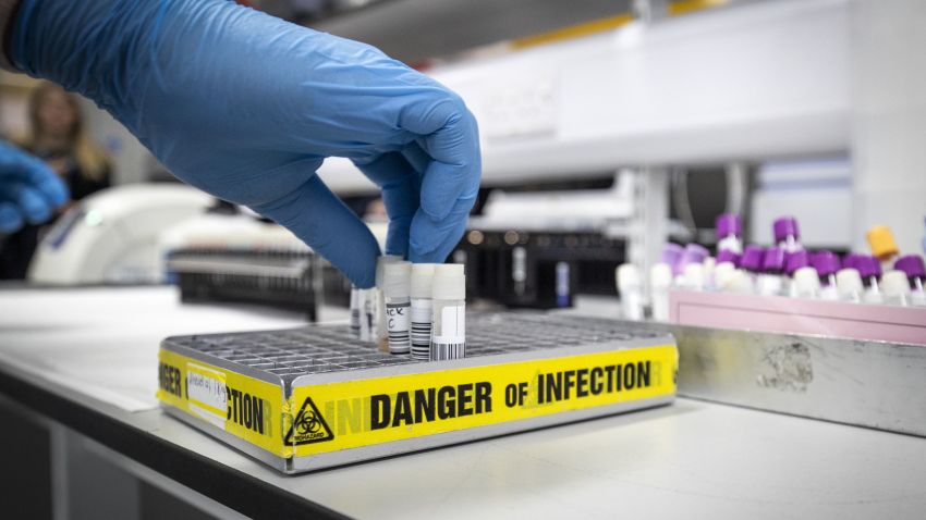 GLASGOW, SCOTLAND - FEBRUARY 19: Clinical support technician Douglas Condie extracts viruses from swab samples so that the genetic structure of a virus can be analysed and identified in the coronavirus testing laboratory at Glasgow Royal Infirmary, on February 19, 2020 in Glasgow, Scotland. (Photo by Jane Barlow - WPA Pool/Getty Images)