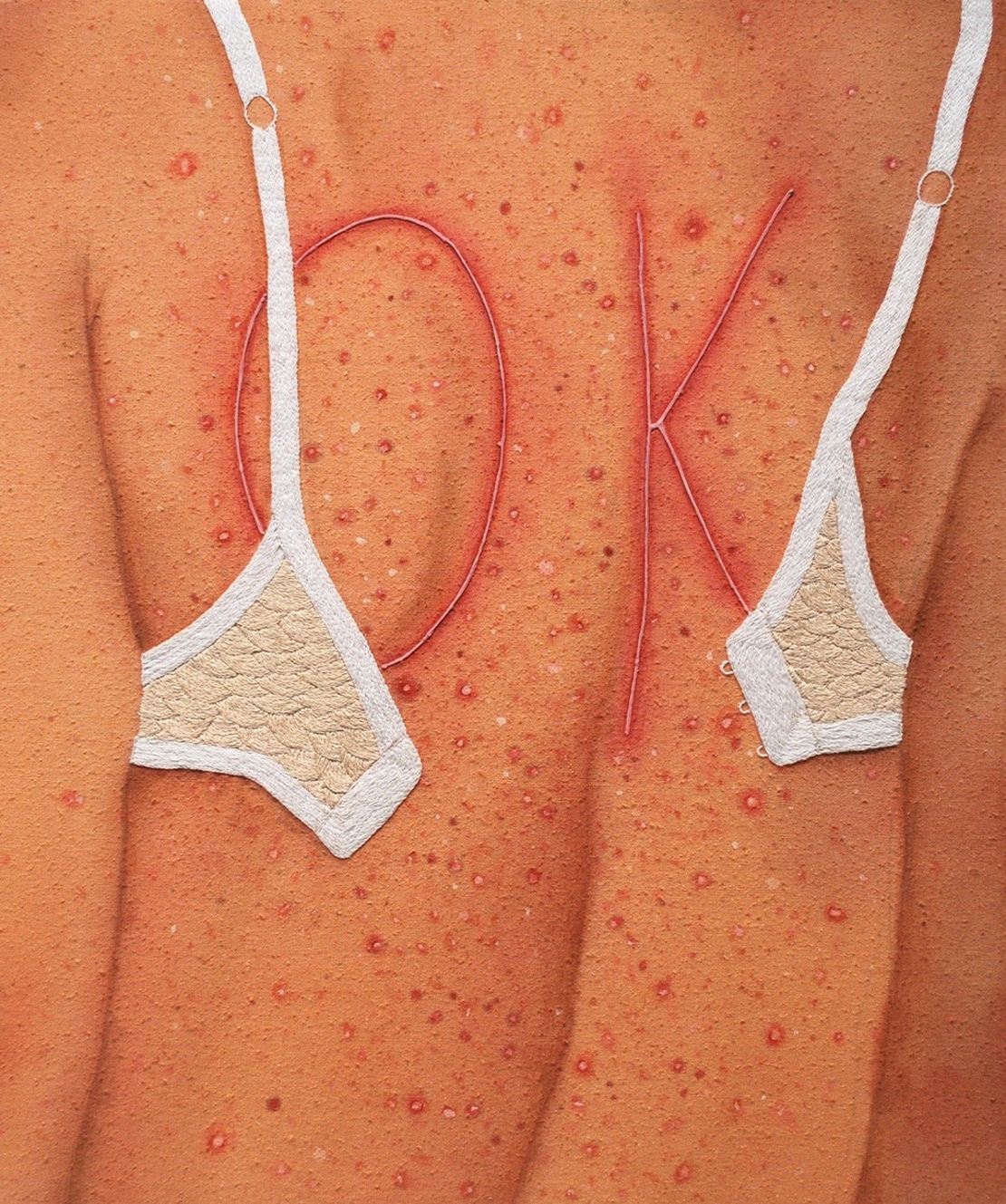 "OK" by Katarina Riesing (2018). Riesing's work highlights seeming imperfections in skin -- acne, scratches and even scars.