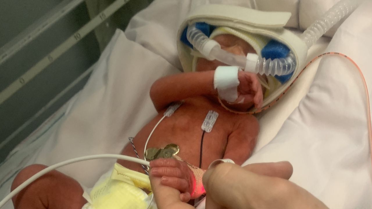 Doctors took Nicolas Mateo Flores to the neonatal intensive care unit as soon as he was born.