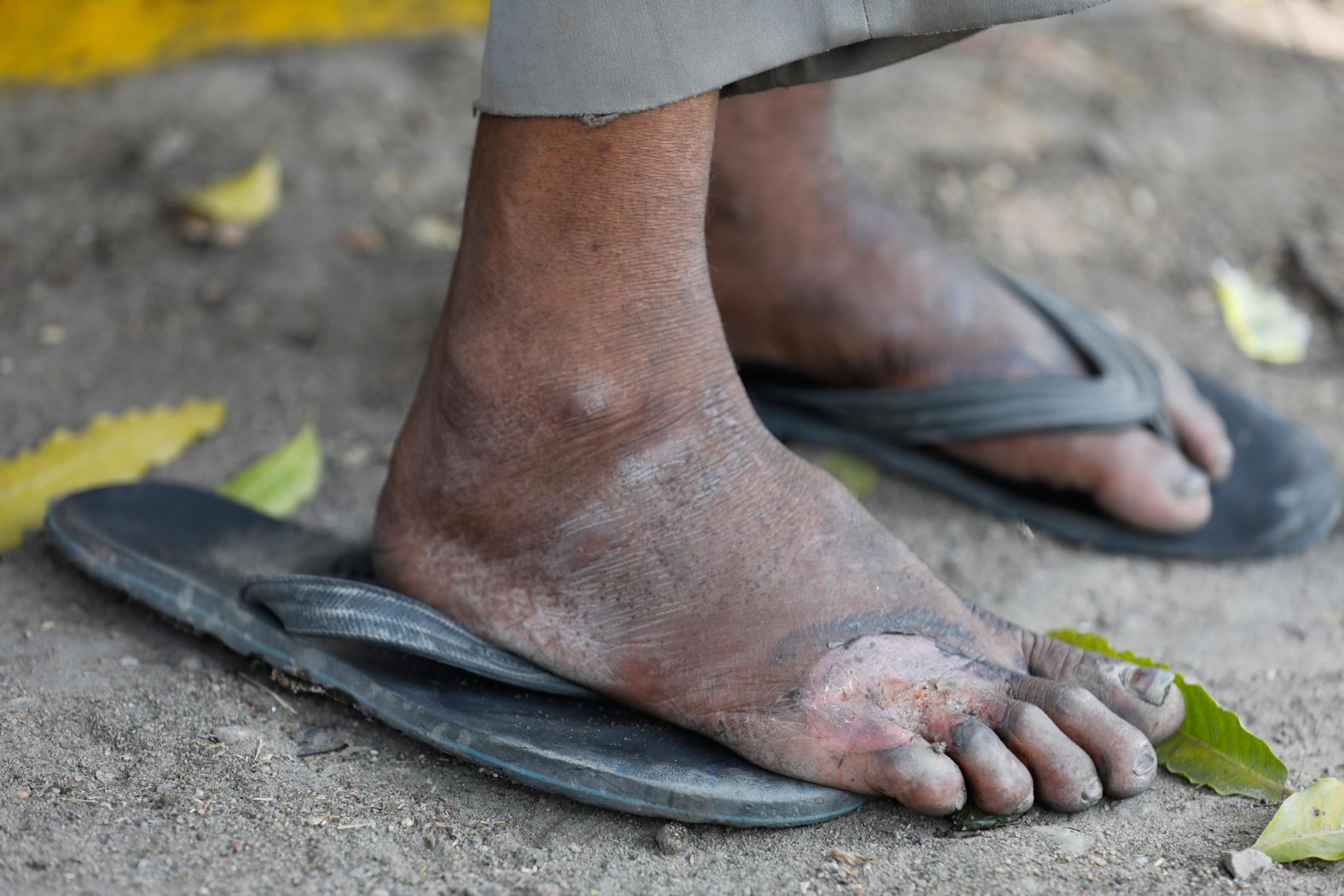 A laborer rests on the outskirts of Prayagraj en route to his village. With India's rail network temporarily shut, many had no choice but to try walking hundreds of miles home.