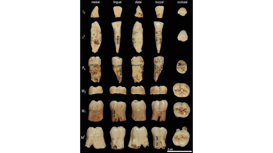 An analysis compared teeth from Homo antecessor and Homo erectus.