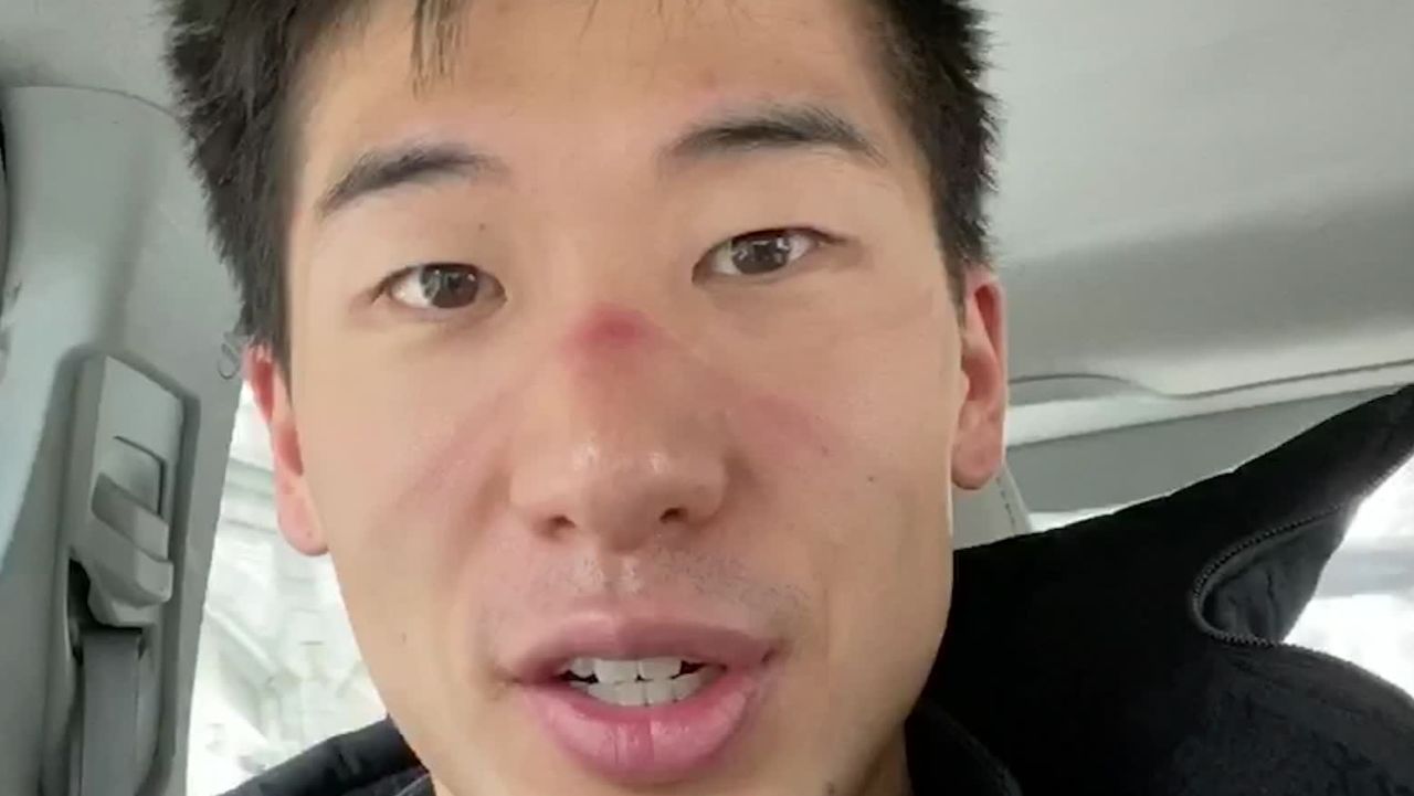 calvin sun er doc
