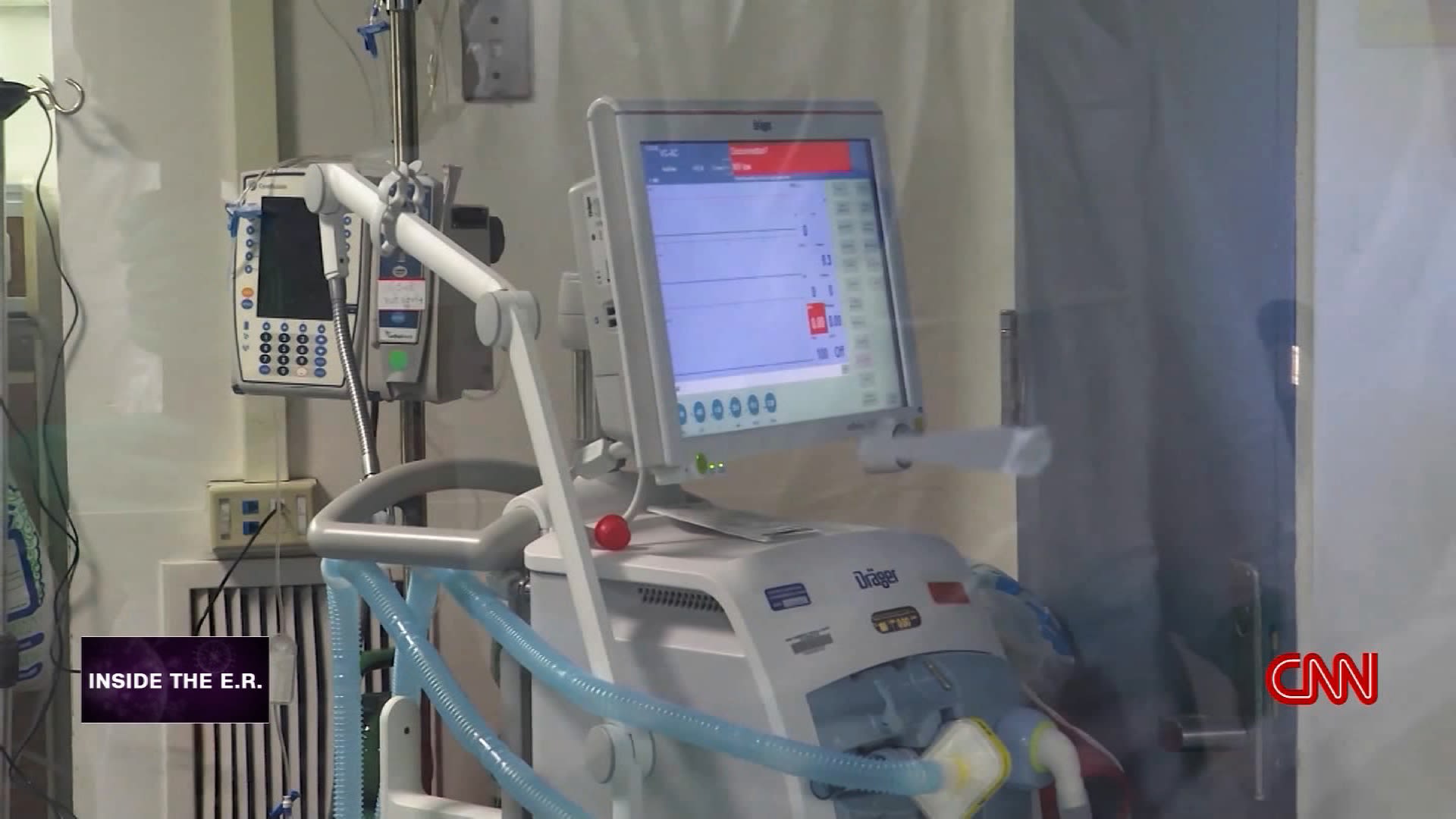 How Long Can A Patient Stay On A Ventilator