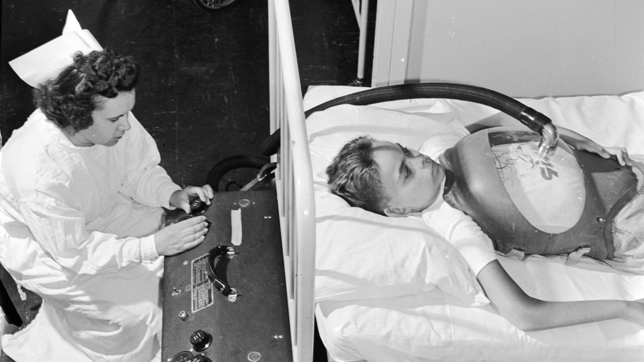A boy suffering from polio is treated with an "iron lung" at a hospital in 1955, while a nurse controls the flow of air pressure. 