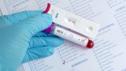 Hepatitis C virus (HCV) testing by using test cassette, the result showed positive (double red line)
