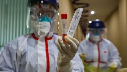 This photo taken on February 4, 2020 shows a medical staff member showing a test tube after taking samples taken from a person to be tested for the new coronavirus at a quarantine zone in Wuhan, the epicentre of the outbreak, in China's central Hubei province. - The world has a "window of opportunity" to halt the spread of a deadly new virus, global health experts said, as the number of people infected in China jumped to 24,000 and millions more were ordered to stay indoors. (Photo by STR / AFP) / China OUT (Photo by STR/AFP via Getty Images)