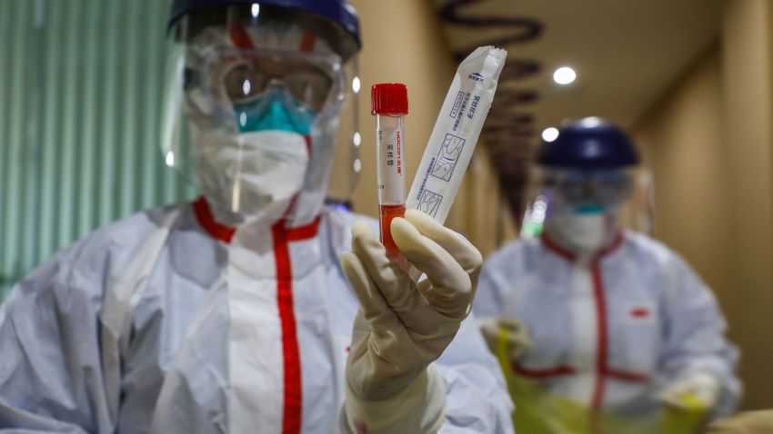 This photo taken on February 4, 2020 shows a medical staff member showing a test tube after taking samples taken from a person to be tested for the new coronavirus at a quarantine zone in Wuhan, the epicentre of the outbreak, in China's central Hubei province. - The world has a "window of opportunity" to halt the spread of a deadly new virus, global health experts said, as the number of people infected in China jumped to 24,000 and millions more were ordered to stay indoors. (Photo by STR / AFP) / China OUT (Photo by STR/AFP via Getty Images)