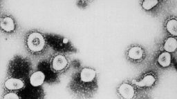 ATLANTA, GA - UNDATED:  This undated handout photo from the Centers for Disease Control and Prevention (CDC) shows a microscopic view of the Coronavirus at the CDC in Atlanta, Georgia. According to the CDC the virus that causes Severe Acute Respiratory Syndrome (SARS) might be a "previously unrecognized virus from the Coronavirus family."  (Photo by CDC/Getty Images)  