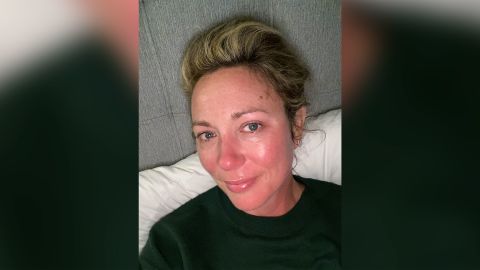 Baldwin said the illness often brought her to tears. She took this photo to remember how bad she felt, physically and emotionally.