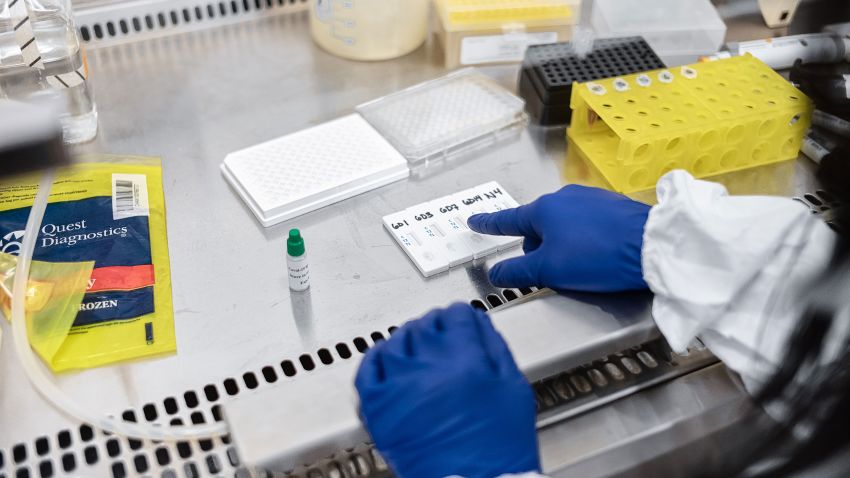 NEW YORK, NY - APRIL 10: Mirimus, Inc. lab scientists work to validate rapid IgM/IgG antibody tests of COVID-19 samples from recovered patients on April 10, 2020 in the Brooklyn borough of New York City. (Photo by Misha Friedman/Getty Images)