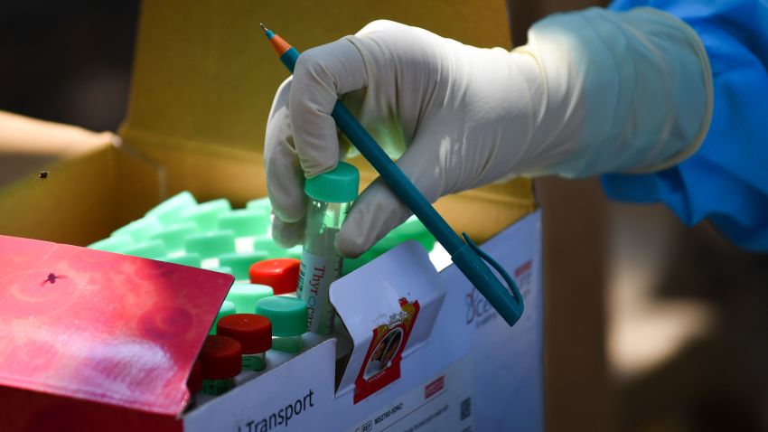 A doctor places a viral transport system swab sample tube at a COVID-19 coronavirus testing drive inside the Dharavi slums during a government-imposed nationwide lockdown as a preventive measure against the spread of the COVID-19 coronavirus, in Mumbai on April 16, 2020. (Photo by INDRANIL MUKHERJEE / AFP) (Photo by INDRANIL MUKHERJEE/AFP via Getty Images)