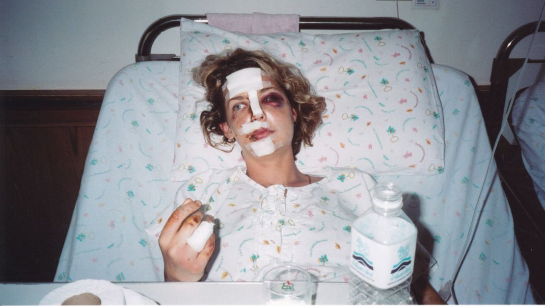 Not the first tourist to wind up in a Thai hospital after a motorcycle mishap, and certainly not the last.