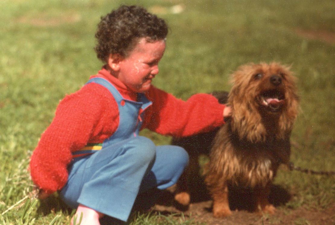 Growing up in Australia, Carly Findlay didn't see anyone on TV with the same skin condition until she was in her late teens.