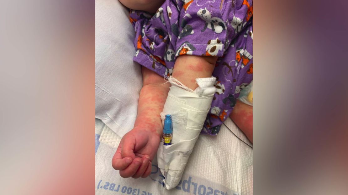 A six-month-old infant diagnosed with Kawasaki disease also tested positive for coronavirus.